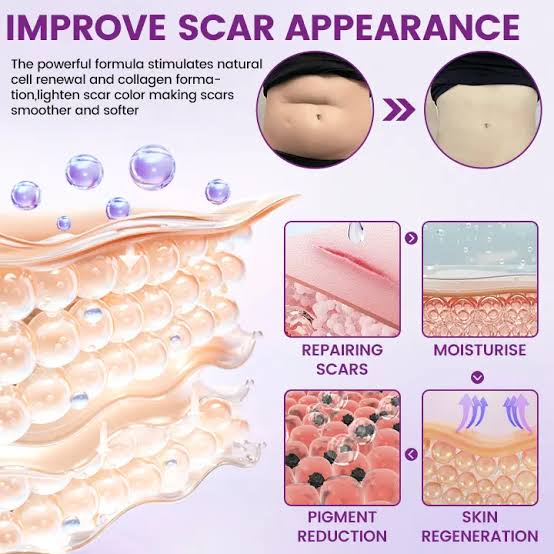 TIMILK Scar Vanisher Gel – Advanced Silicone Formula for Scars, Stretch Marks & Smooth Skin (Before & After Results)